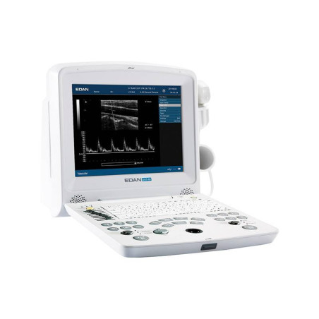 ECHOGRAPHE PORTABLE DUS60